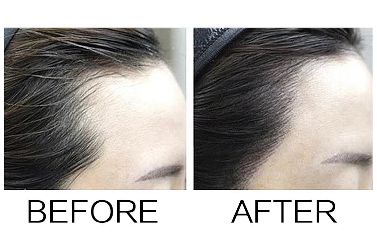 Sevich Hairline Powder 4g Hairline Shadow Powder Women Men Makeup Hair Concealer Natural Cover Unisex Hair Straightener Brush