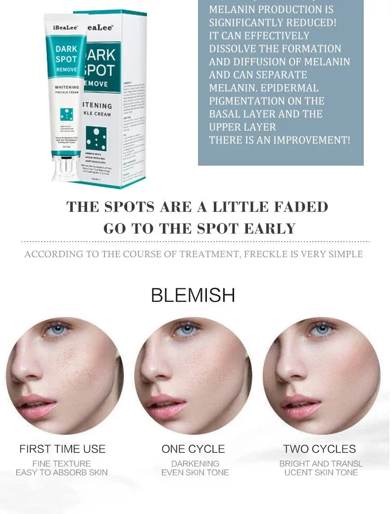 Melasma Brightening Face Cream Niacinamide Serum Brighten Cream Fade Fine Lines Lighten Dark Dot Reduce Melanin Face Skincare