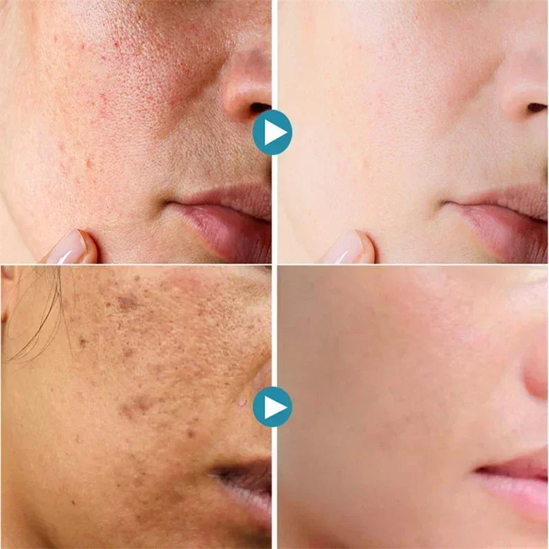 Pore Shrink Face Serum Remove Blackheads Acne Acidity Oil Control Repair Essence Moisturizing Nourish Pores Firming Facial Care