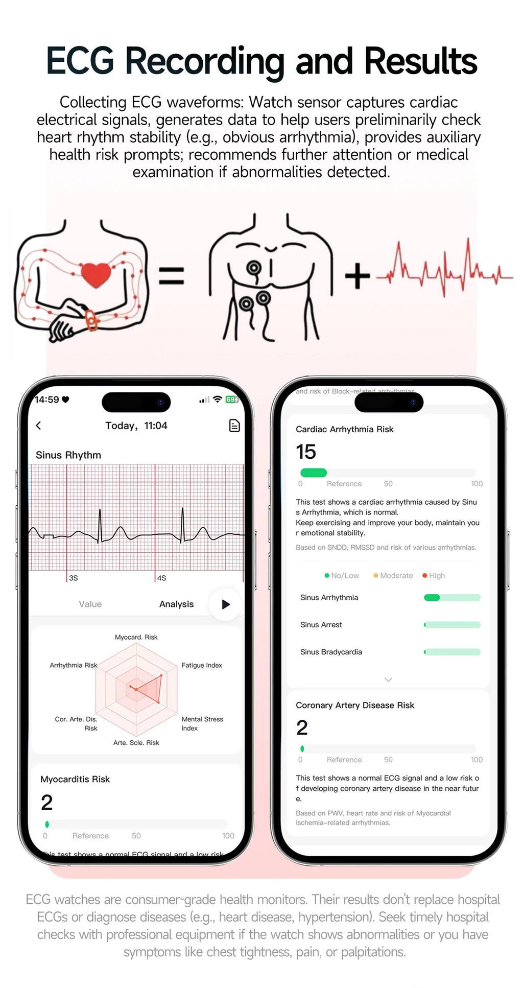 2026 New ECG+PPG Healthy Diagnose Smart Watch Men Body analysis Blood Pressure Lipid Uric Acid Women's Health Tracker Smartwatch