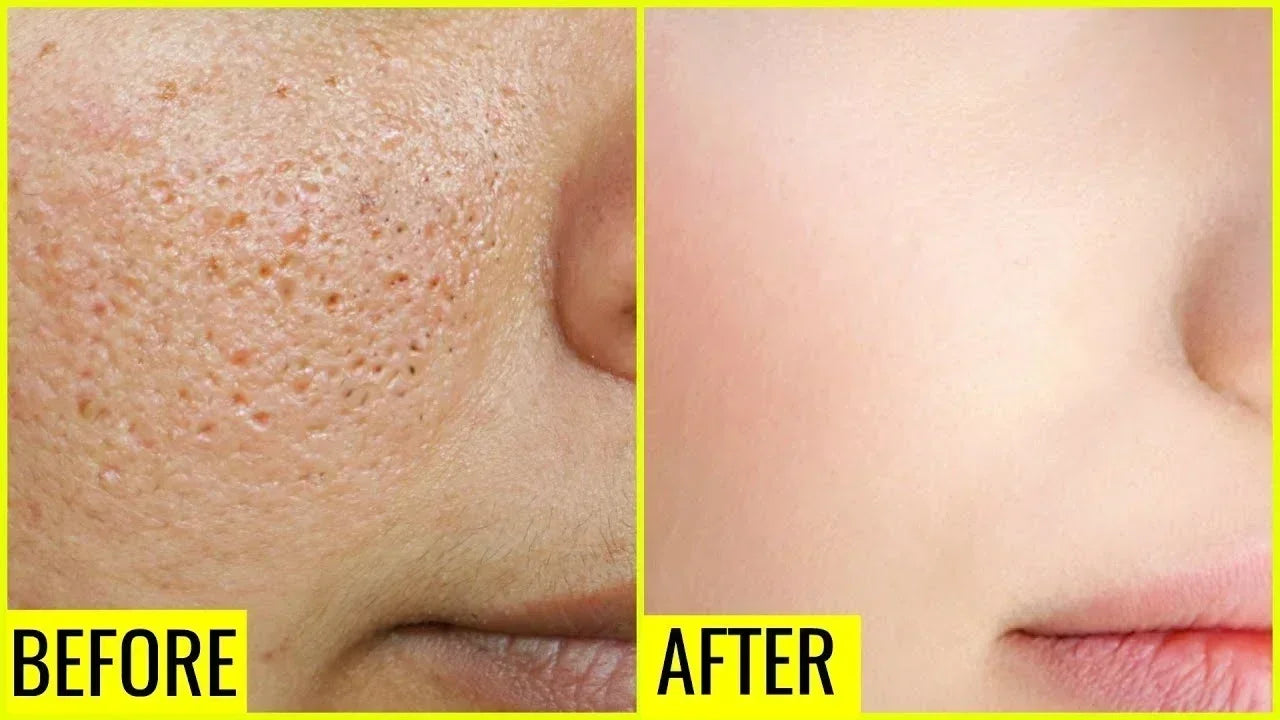 Pore Shrink Face Serum Remove Blackheads Acne Acidity Oil Control Repair Essence Moisturizing Nourish Pores Firming Facial Care