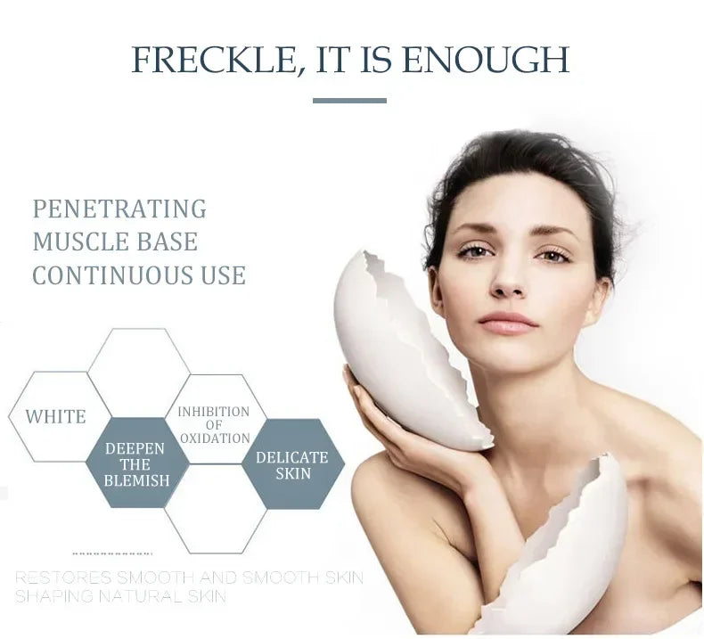 Melasma Brightening Face Cream Niacinamide Serum Brighten Cream Fade Fine Lines Lighten Dark Dot Reduce Melanin Face Skincare